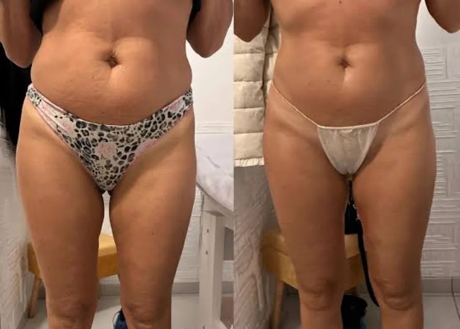 Prima e dopo di Matilde